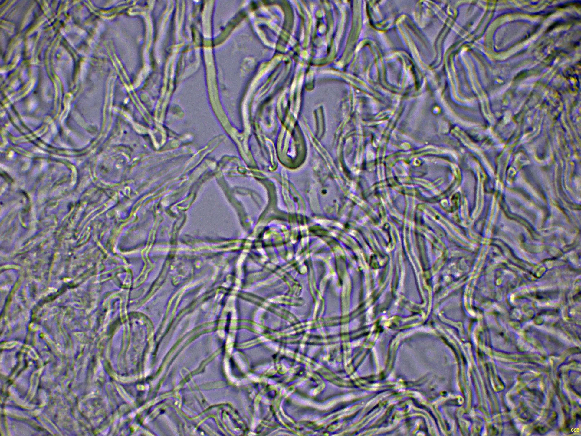 Microscopía de Perenniporia meridionalis - 10 - Hifas KOH-005